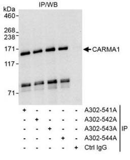 Detection of human CARMA1 by western blot of immunoprecipitates.