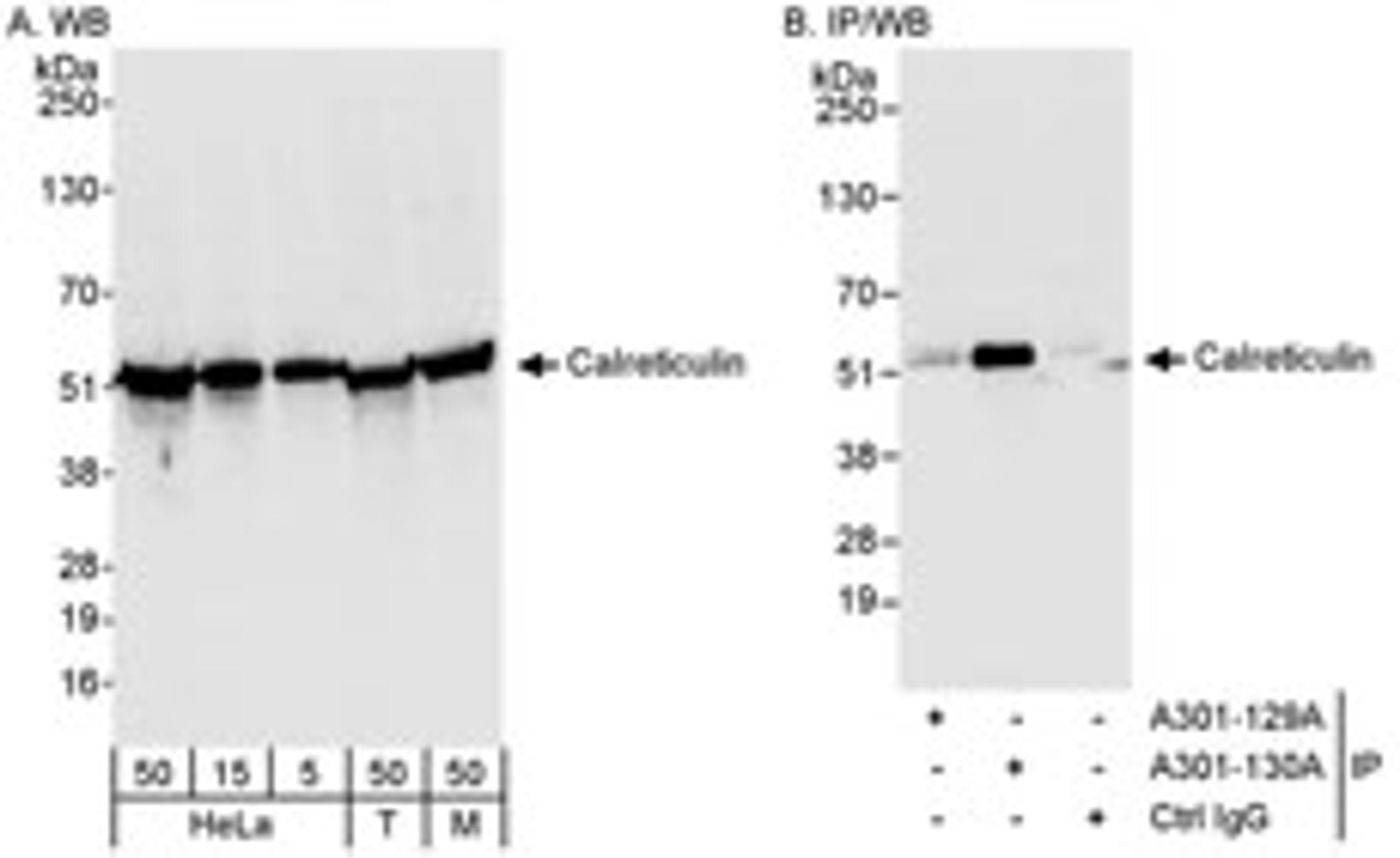 Detection of human and mouse Calreticulin by western blot (h&m) and immunoprecipitation (h).