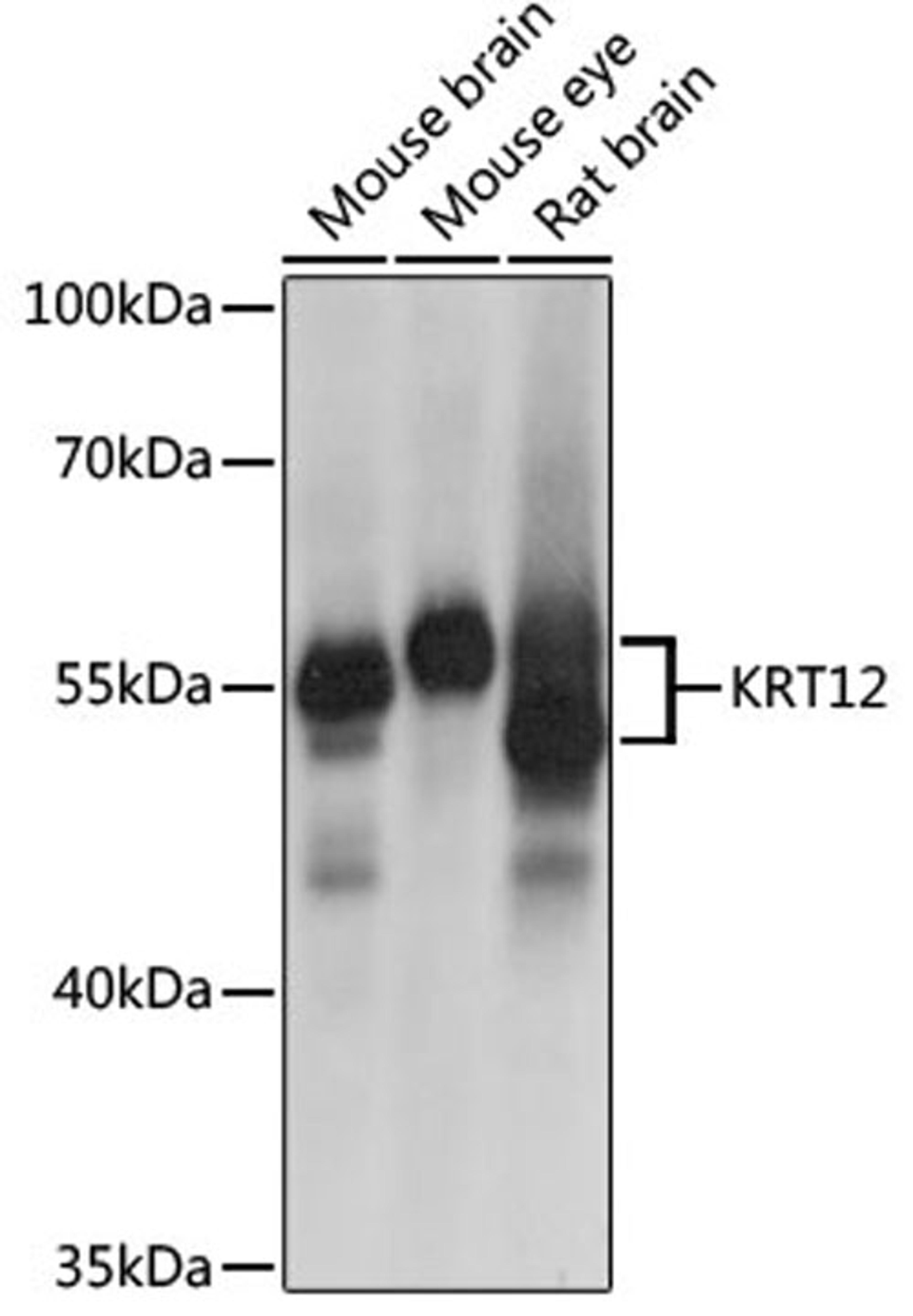 Western blot - KRT12 antibody (A9642)