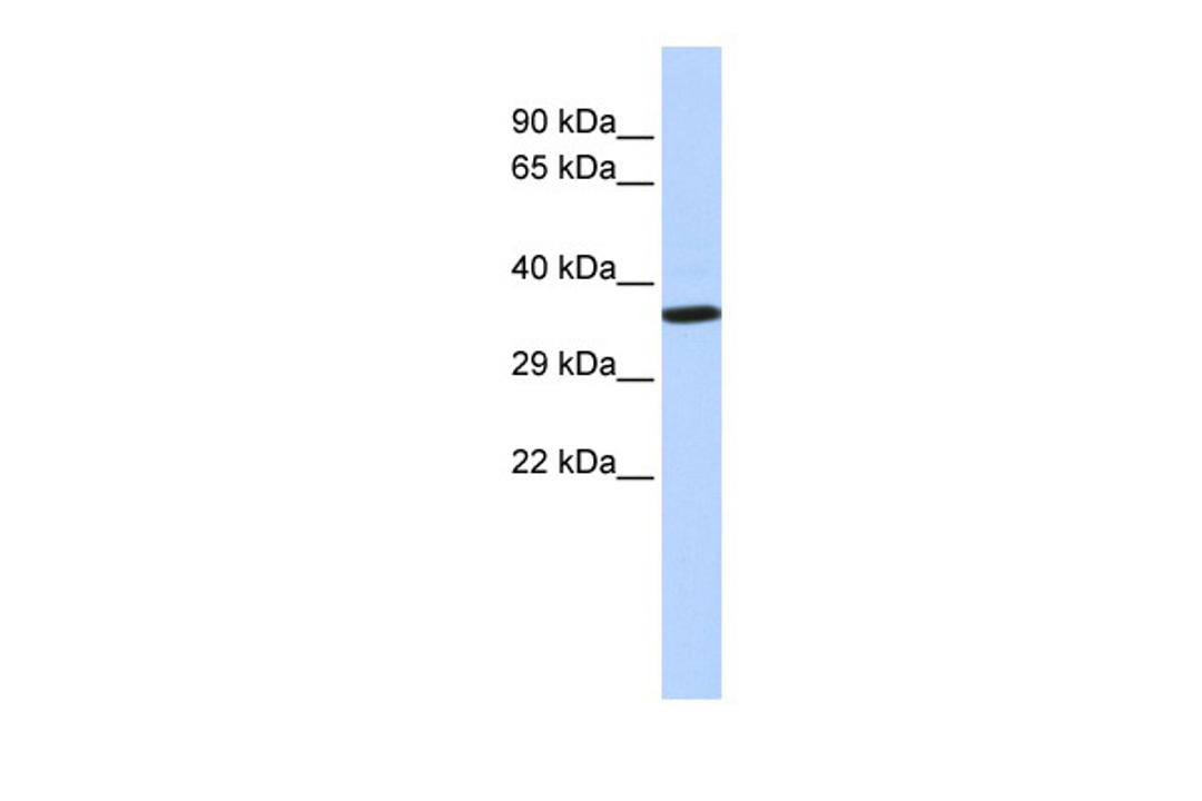 Antibody used in WB on Human Placenta at 0.2-1 ug/ml.