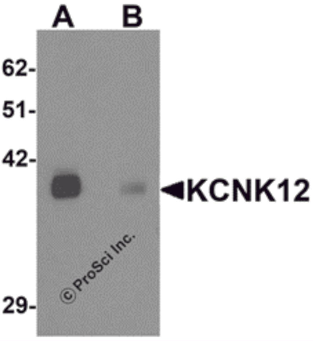 Western blot analysis of KCNK12 in rat brain tissue lysate with KCNK12 antibody at 0.5 μg/mL in (A) the absence and (B) the presence of blocking peptide.