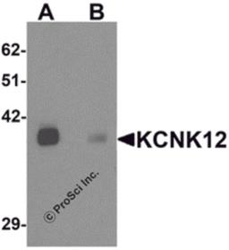 Western blot analysis of KCNK12 in rat brain tissue lysate with KCNK12 antibody at 0.5 μg/mL in (A) the absence and (B) the presence of blocking peptide.