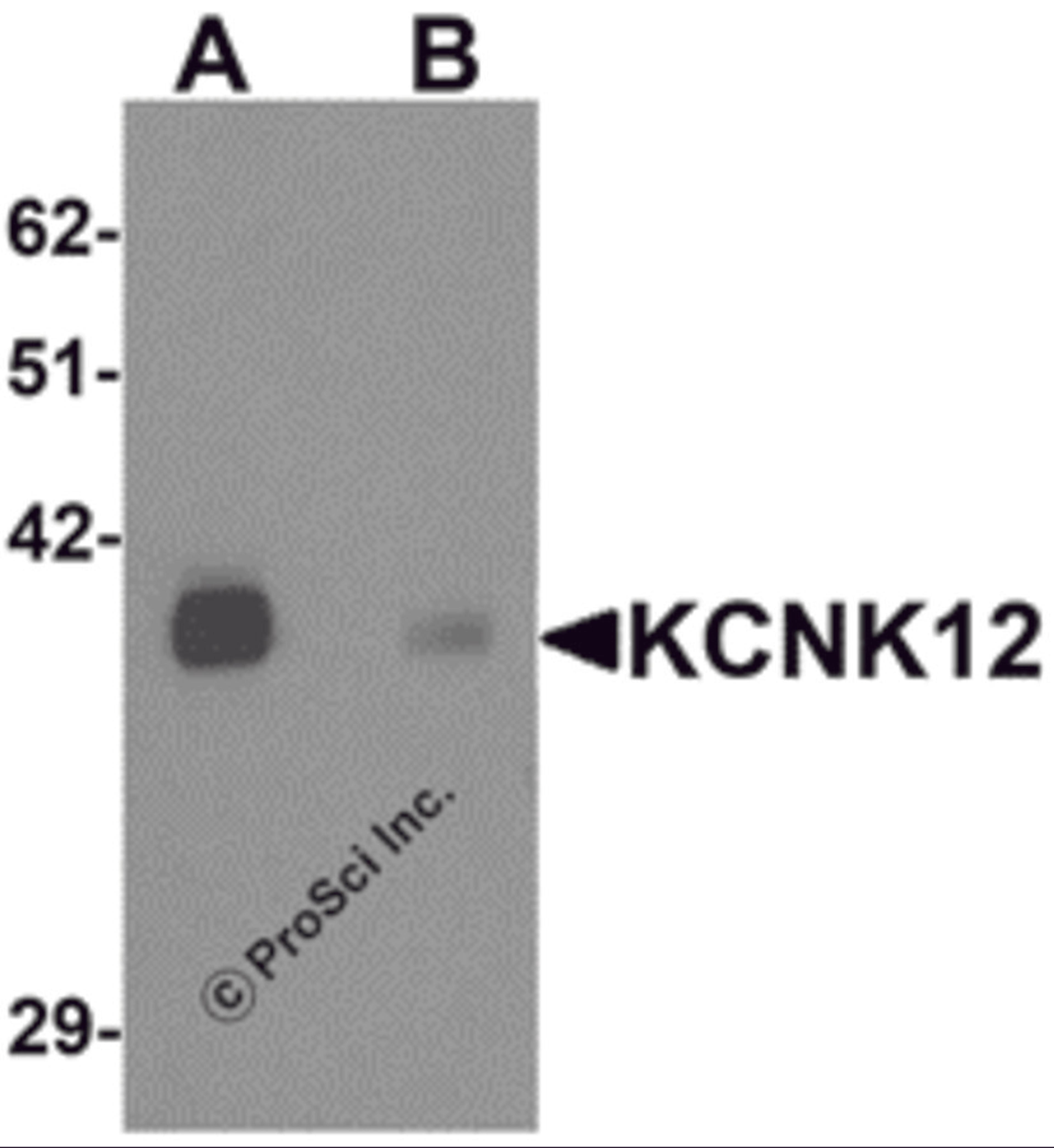 Western blot analysis of KCNK12 in rat brain tissue lysate with KCNK12 antibody at 0.5 μg/mL in (A) the absence and (B) the presence of blocking peptide.
