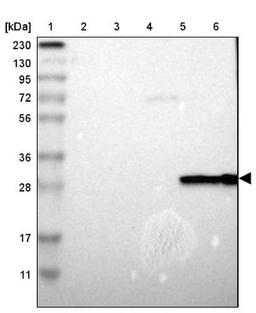 Western Blot: Carbonic Anhydrase I Antibody [NBP1-88191] - Lane 1: Marker [kDa] 230, 130, 95, 72, 56, 36, 28, 17, 11<br/>Lane 2: Human cell line RT-4<br/>Lane 3: Human cell line U-251MG sp<br/>Lane 4: Human plasma (IgG/HSA depleted)<br/>Lane 5: Human liver tissue<br/>Lane 6: Human tonsil tissue