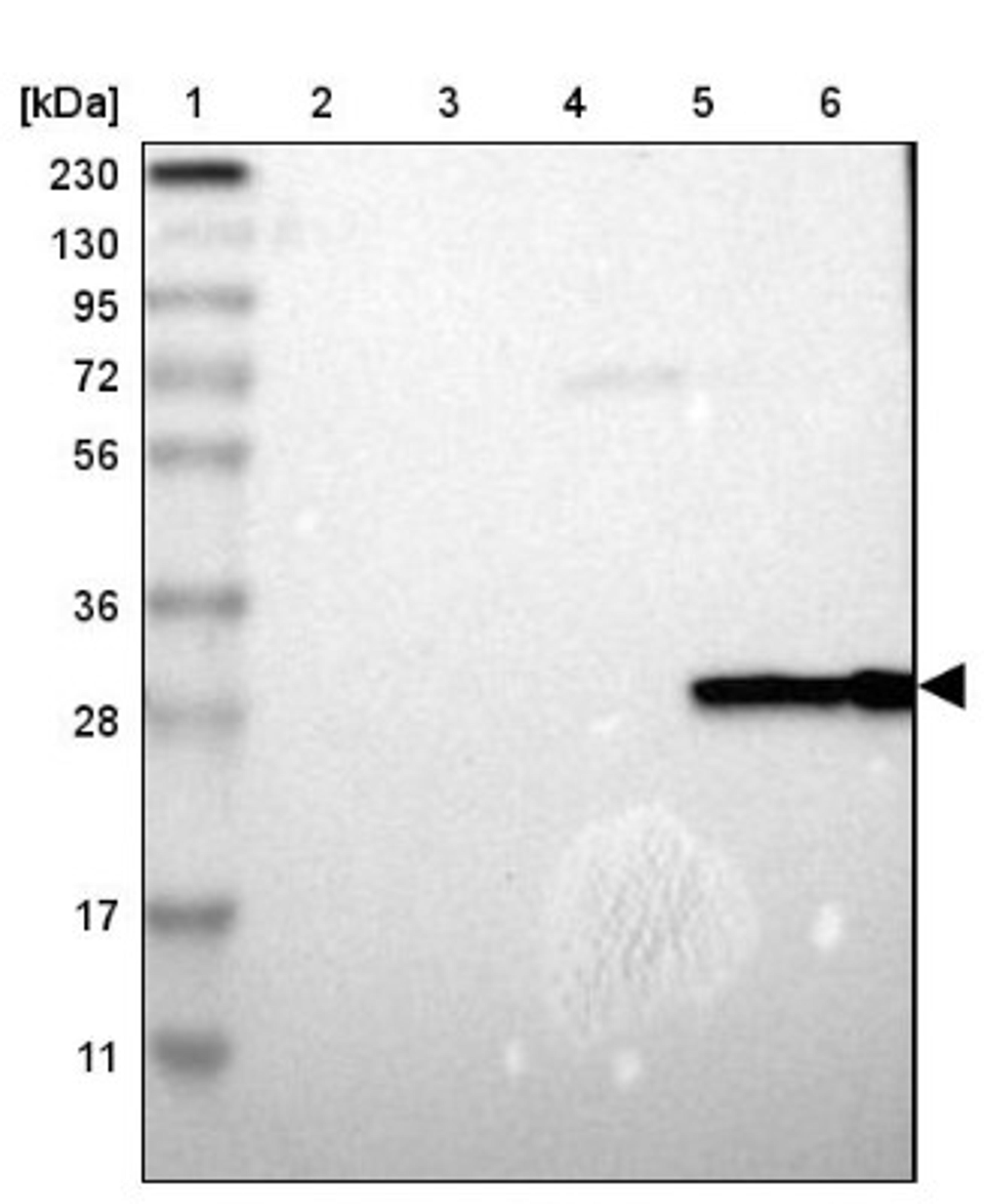 Western Blot: Carbonic Anhydrase I Antibody [NBP1-88191] - Lane 1: Marker [kDa] 230, 130, 95, 72, 56, 36, 28, 17, 11<br/>Lane 2: Human cell line RT-4<br/>Lane 3: Human cell line U-251MG sp<br/>Lane 4: Human plasma (IgG/HSA depleted)<br/>Lane 5: Human liver tissue<br/>Lane 6: Human tonsil tissue