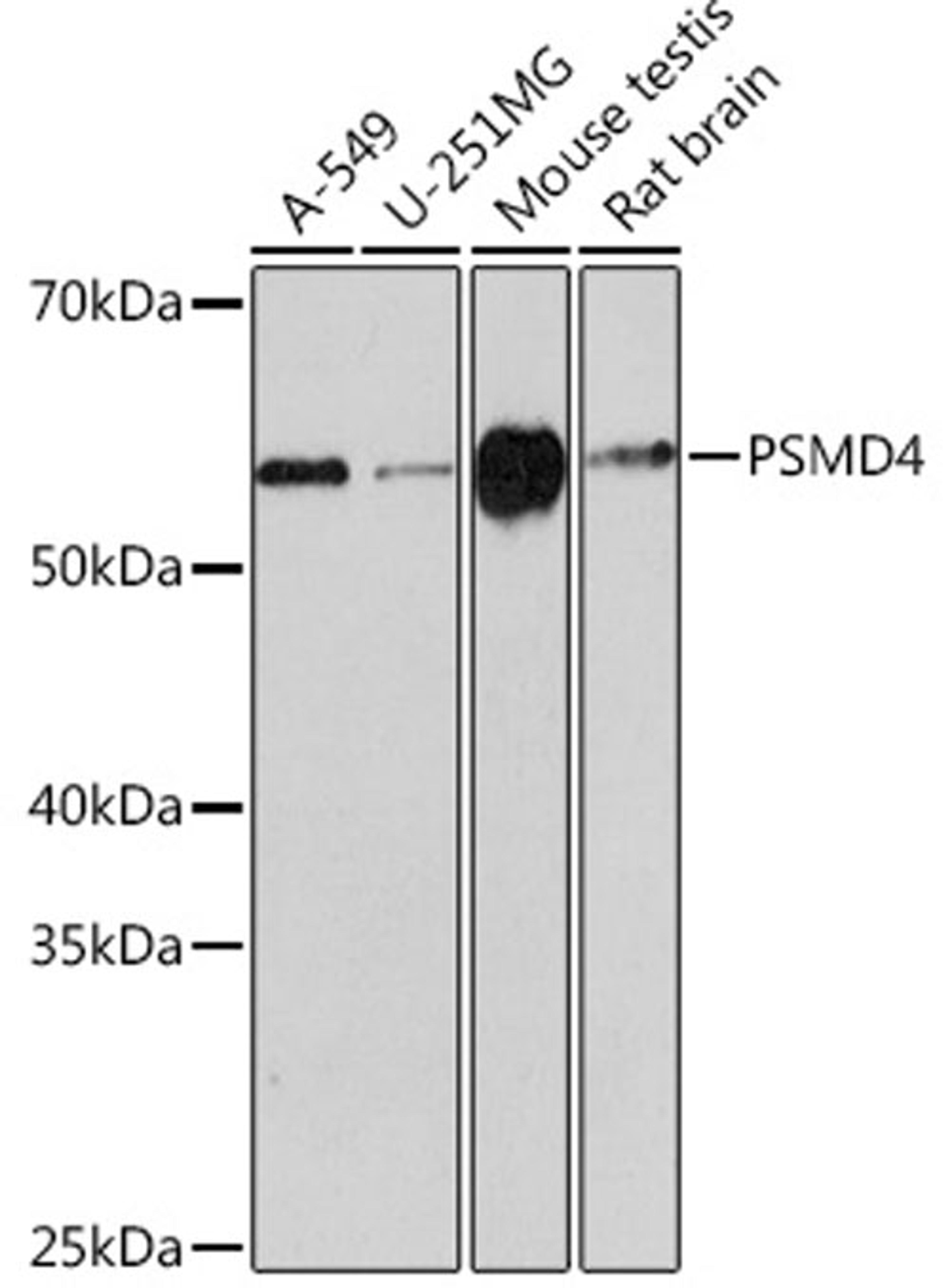Western blot - PSMD4 Rabbit mAb (A3663)