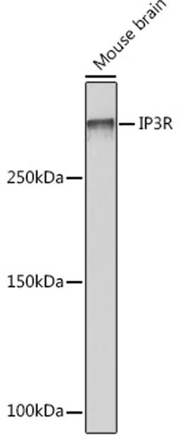 Western blot - IP3R Rabbit mAb (A4436)