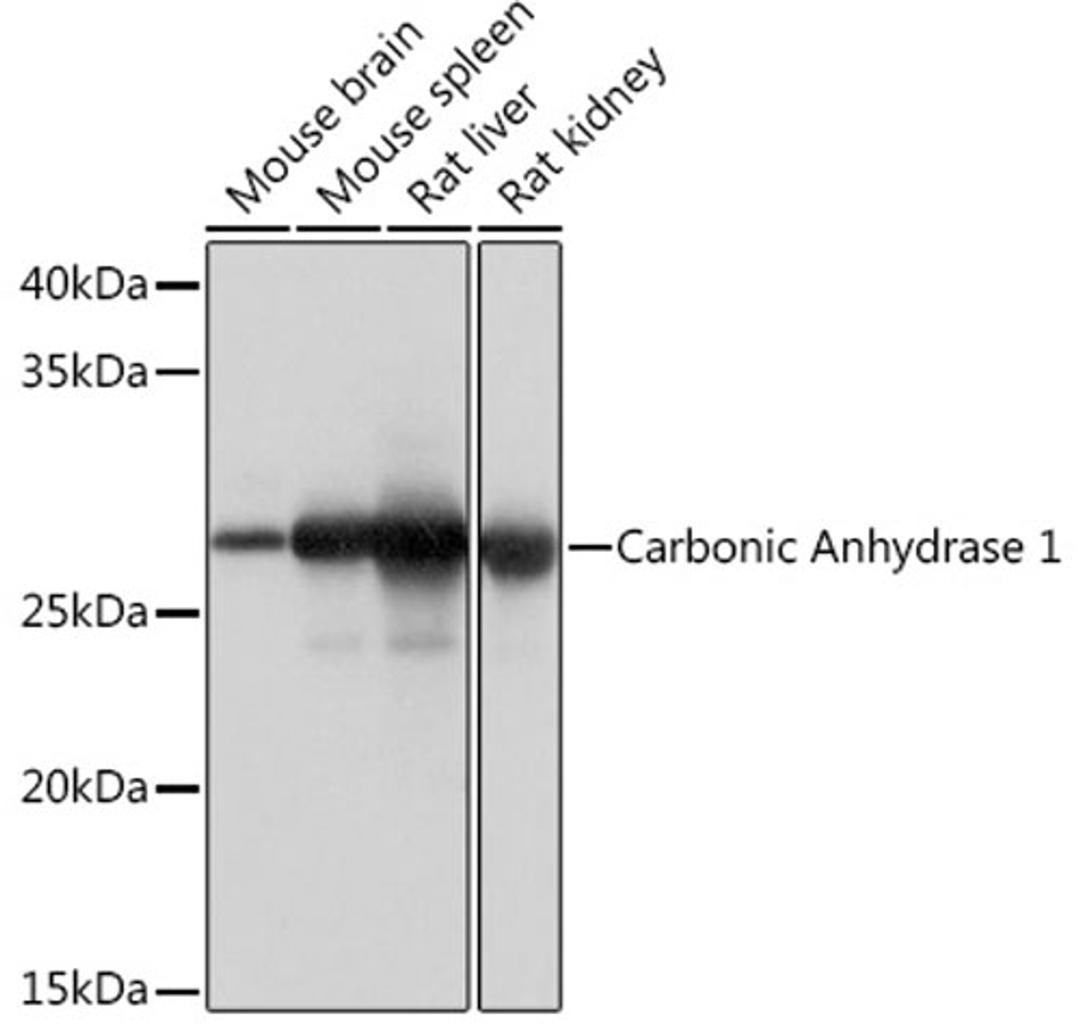 Western blot - Carbonic Anhydrase 1 Rabbit mAb (A4406)