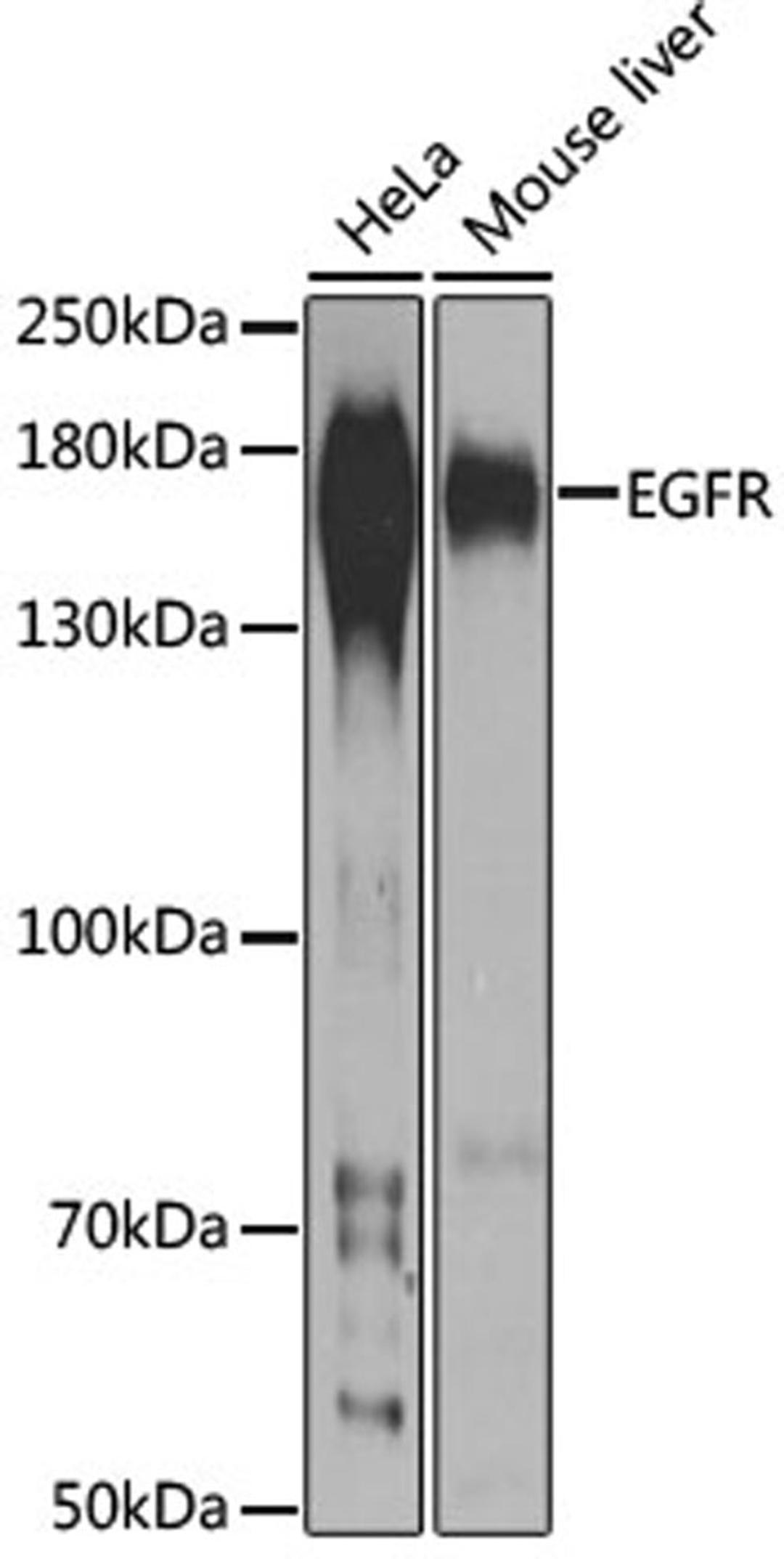 Western blot - EGFR antibody (A11352)