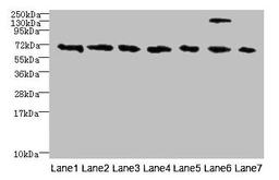 Western blot. All lanes: TRPM2 antibody at 3µg/ml. Lane 1: HepG2 whole cell lysate. Lane 2: Mouse brain tissue. Lane 3: A549 whole cell lysate. Lane 4: K562 whole cell lysate. Lane 5: Mouse kidney tissue. Lane 6: Human placenta tissue. Lane 7: Mouse spleen tissue. Secondary. Goat polyclonal to rabbit IgG at 1/10000 dilution. Predicted band size: 172, 166, 96 kDa. Observed band size: 70 kDa