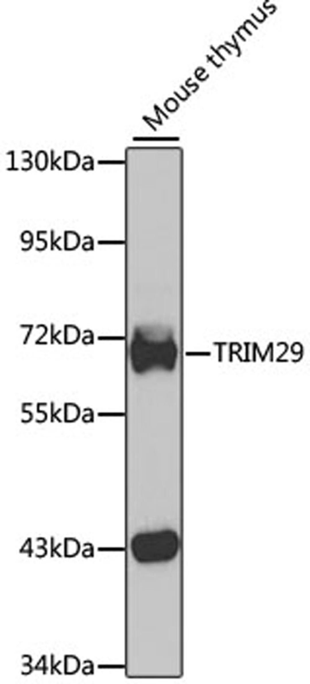 Western blot - TRIM29 antibody (A7508)