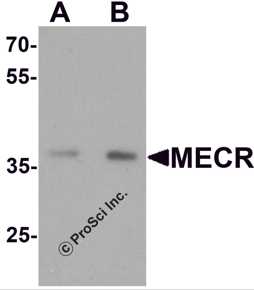 Western blot analysis of MECR in human brain tissue lysate with MECR antibody at (A) 1 and (B) 2 &#956;g/mL.