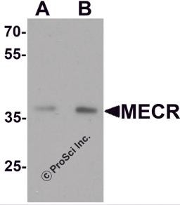 Western blot analysis of MECR in human brain tissue lysate with MECR antibody at (A) 1 and (B) 2 &#956;g/mL.