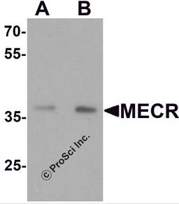 Western blot analysis of MECR in human brain tissue lysate with MECR antibody at (A) 1 and (B) 2 μg/mL.