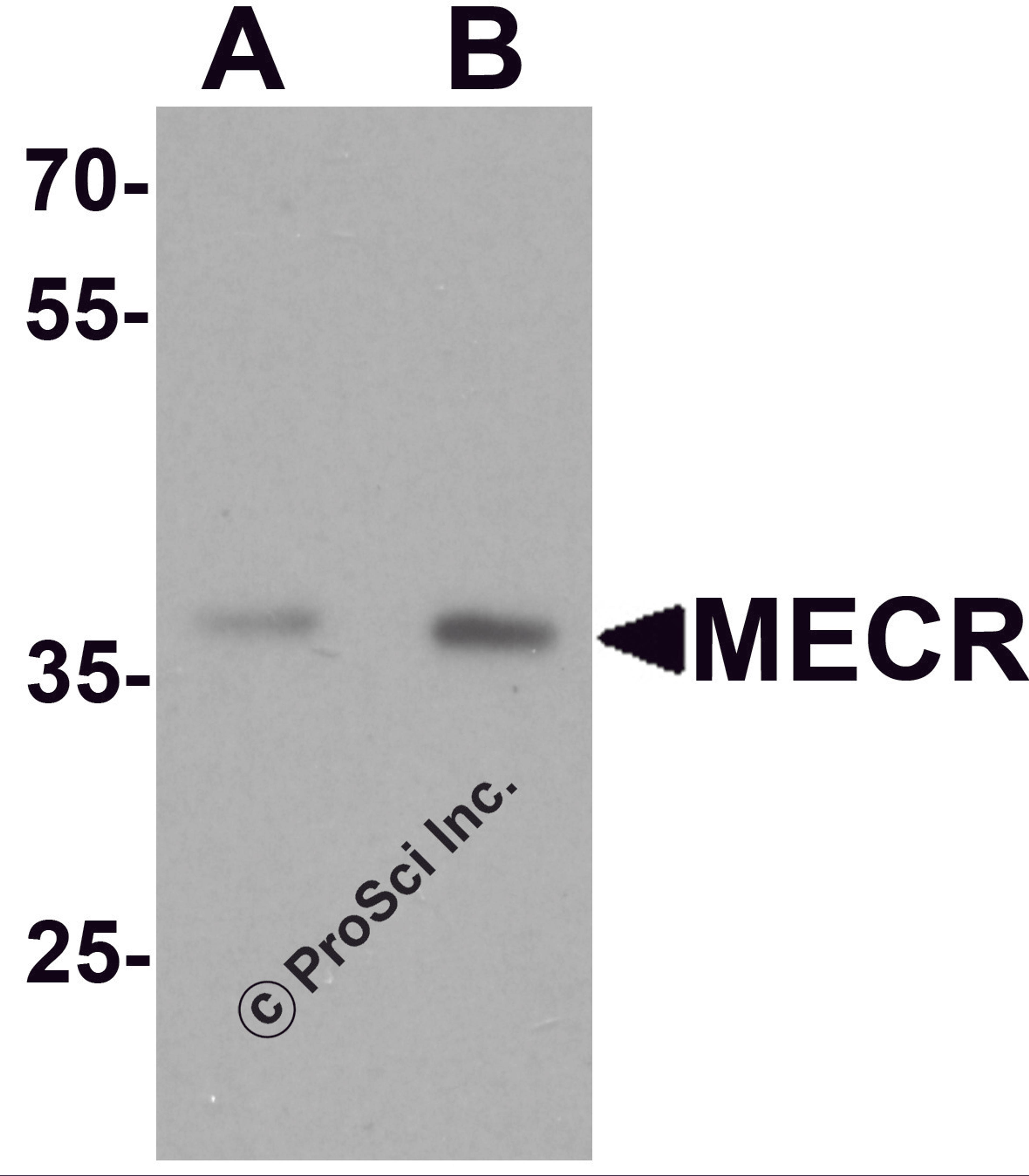 Western blot analysis of MECR in human brain tissue lysate with MECR antibody at (A) 1 and (B) 2 μg/mL.