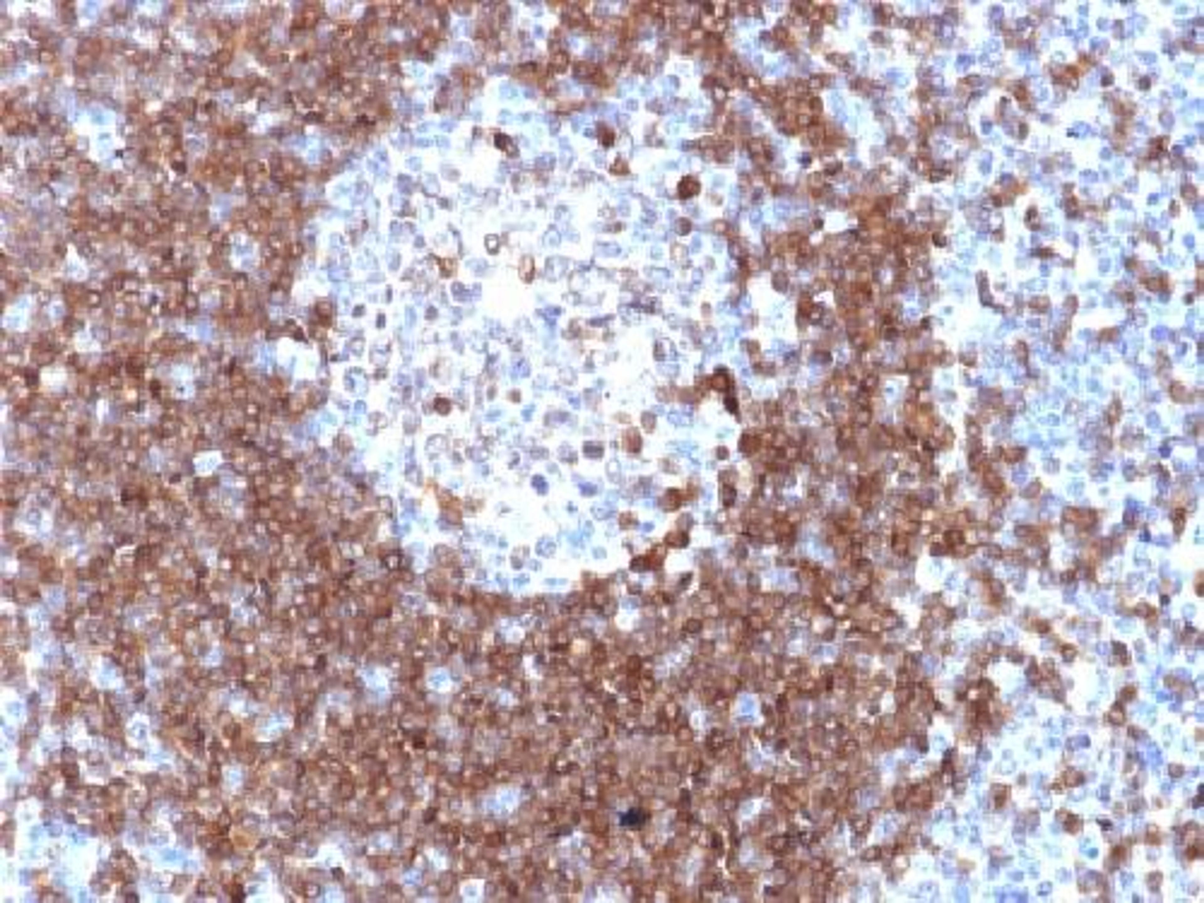 Immunohistochemical staining of human Tonsil tissue using CD79A antibody