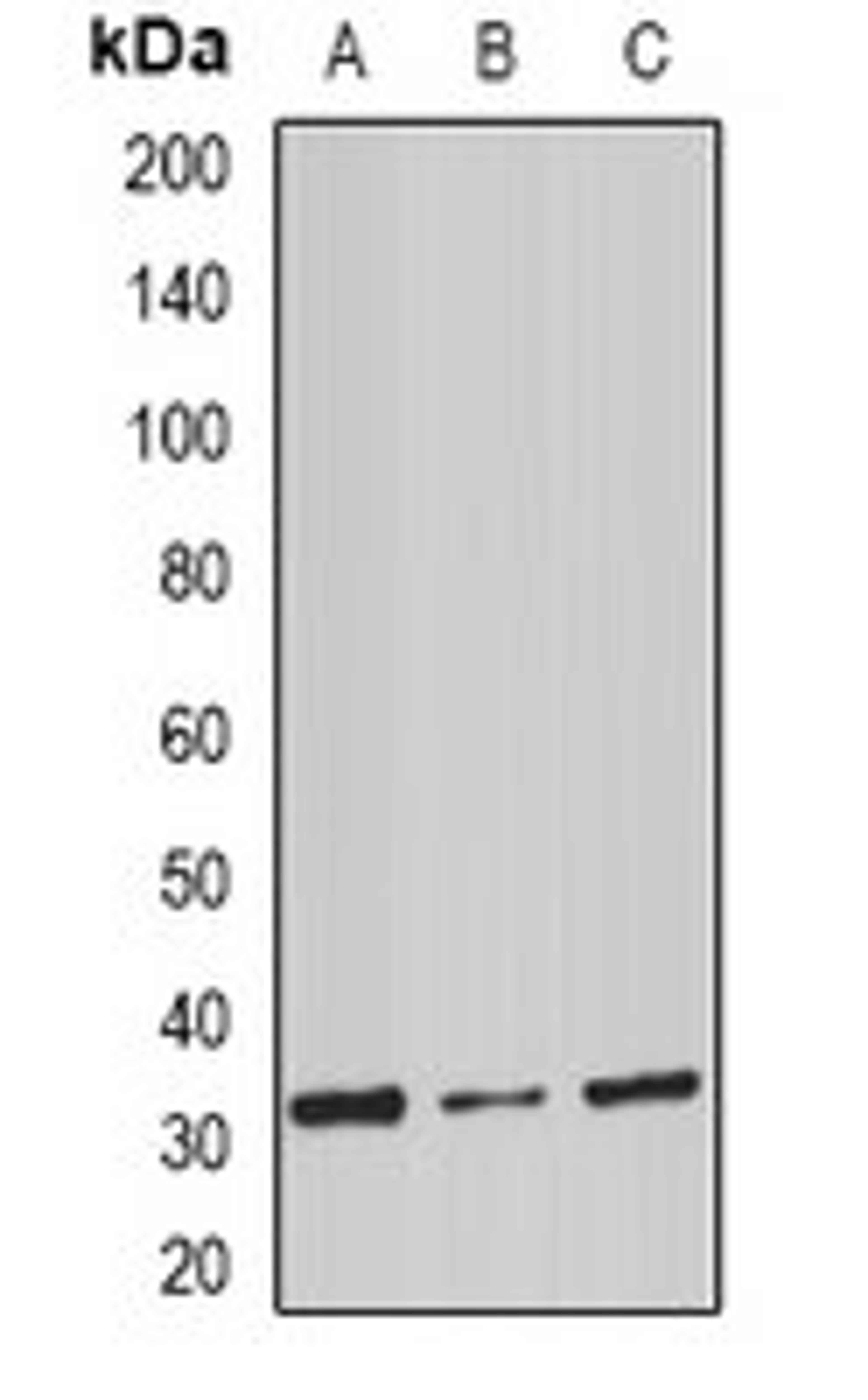 Western blot analysis of mouse spleen (Lane1), mouse heart (Lane2), rat liver (Lane3) whole cell lysates using STOM antibody