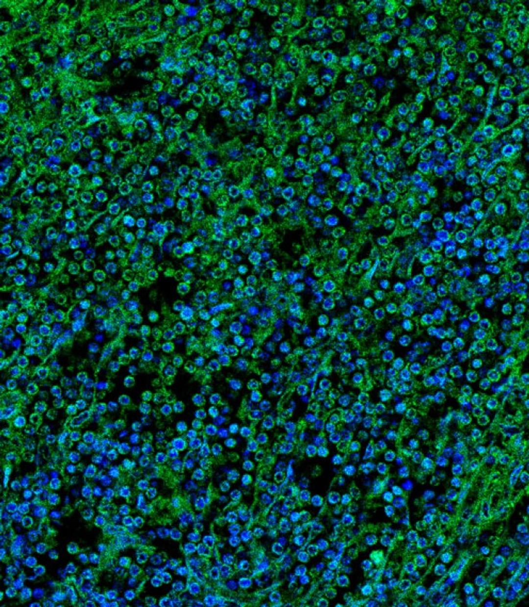 Immunofluorescent analysis of 4% paraformaldehyde-fixed, 0. 1% Triton X-100 permeabilized human spleen tissue labeling Pdx1 with AP9450a at 1/25 dilution, followed by Alexa Fluor 488-conjugated goat anti-rabbit IgG (1583138) secondary antibody at 1/400 di