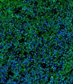 Immunofluorescent analysis of 4% paraformaldehyde-fixed, 0. 1% Triton X-100 permeabilized human spleen tissue labeling Pdx1 with AP9450a at 1/25 dilution, followed by Alexa Fluor 488-conjugated goat anti-rabbit IgG (1583138) secondary antibody at 1/400 di