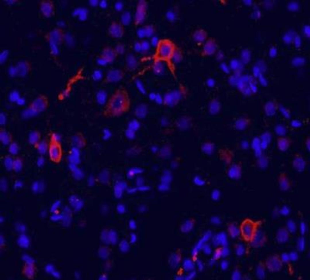 Immunohistochemistry-Frozen: metabotropic Glutamate Receptor 1a Antibody [NB110-39033] - Immunofluorescence labeling for GluR1 in rat brain (cingulate cortex). GluR1 detection  was done using anti-rabbit Cy3 conjugated antibodies (red color). DAPI was used to counterstain cell nuclei (blue color).  Working dilution is 1:100-1:500.