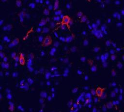 Immunohistochemistry-Frozen: metabotropic Glutamate Receptor 1a Antibody [NB110-39033] - Immunofluorescence labeling for GluR1 in rat brain (cingulate cortex). GluR1 detection  was done using anti-rabbit Cy3 conjugated antibodies (red color). DAPI was used to counterstain cell nuclei (blue color).  Working dilution is 1:100-1:500.