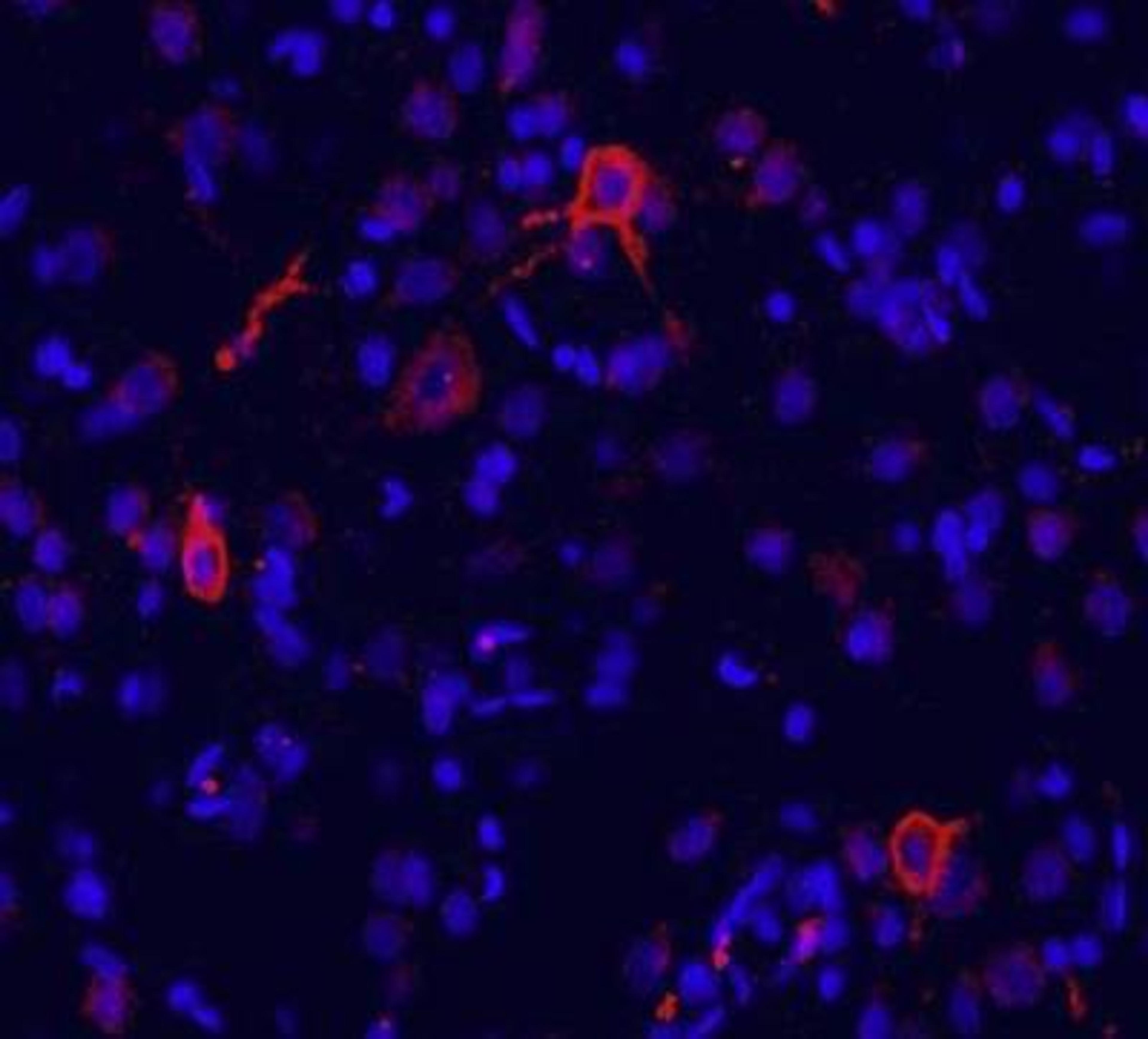 Immunohistochemistry-Frozen: metabotropic Glutamate Receptor 1a Antibody [NB110-39033] - Immunofluorescence labeling for GluR1 in rat brain (cingulate cortex). GluR1 detection  was done using anti-rabbit Cy3 conjugated antibodies (red color). DAPI was used to counterstain cell nuclei (blue color).  Working dilution is 1:100-1:500.