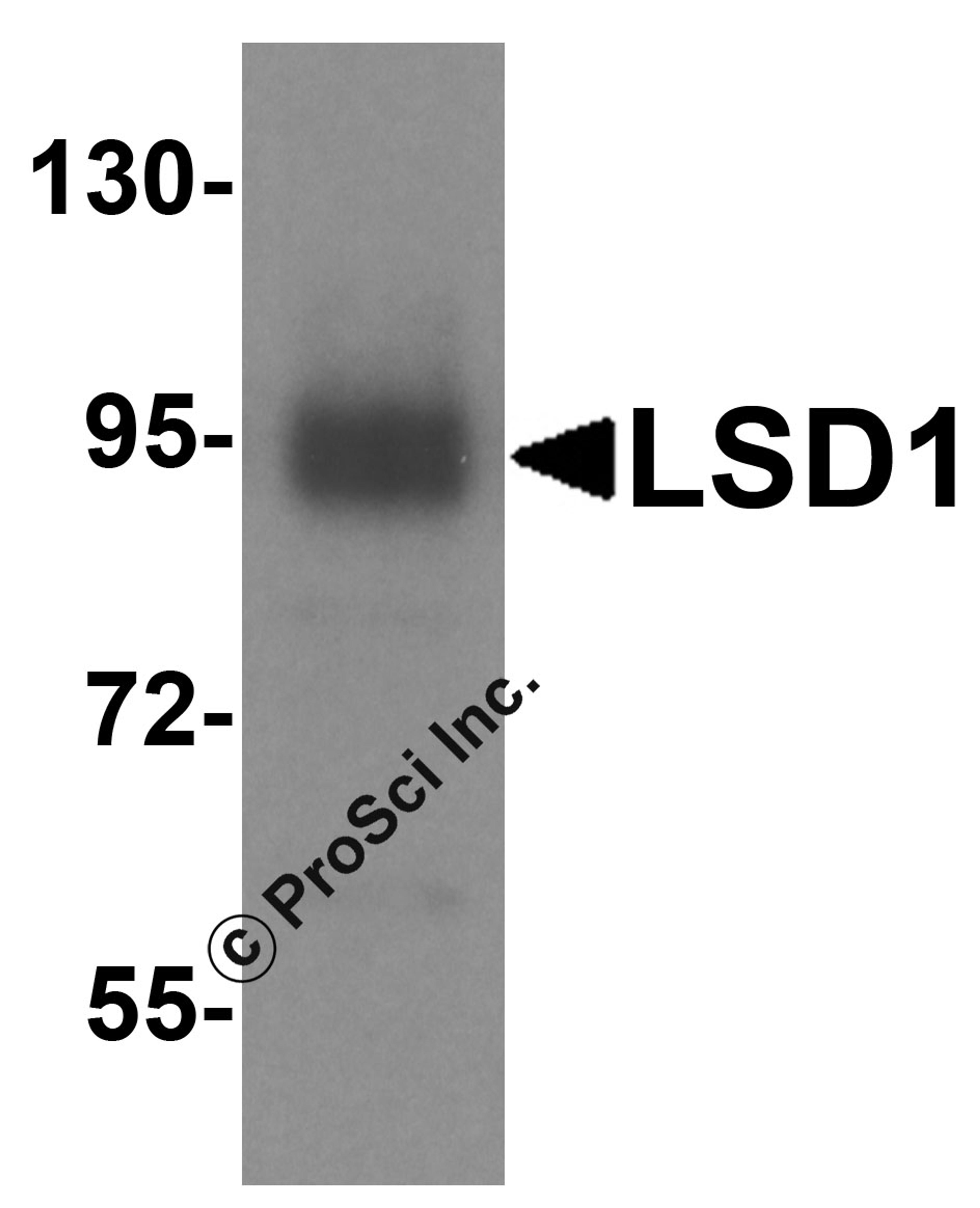 Western blot analysis of LSD1 in A549 cell lysate with LSD1 antibody at 1 μg/ml.