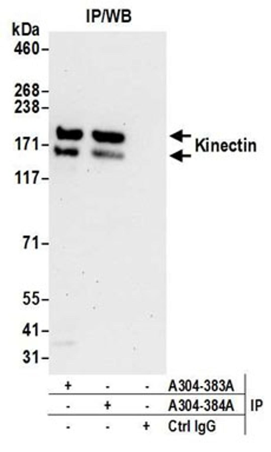 Detection of human Kinectin by western blot of immunoprecipitates.