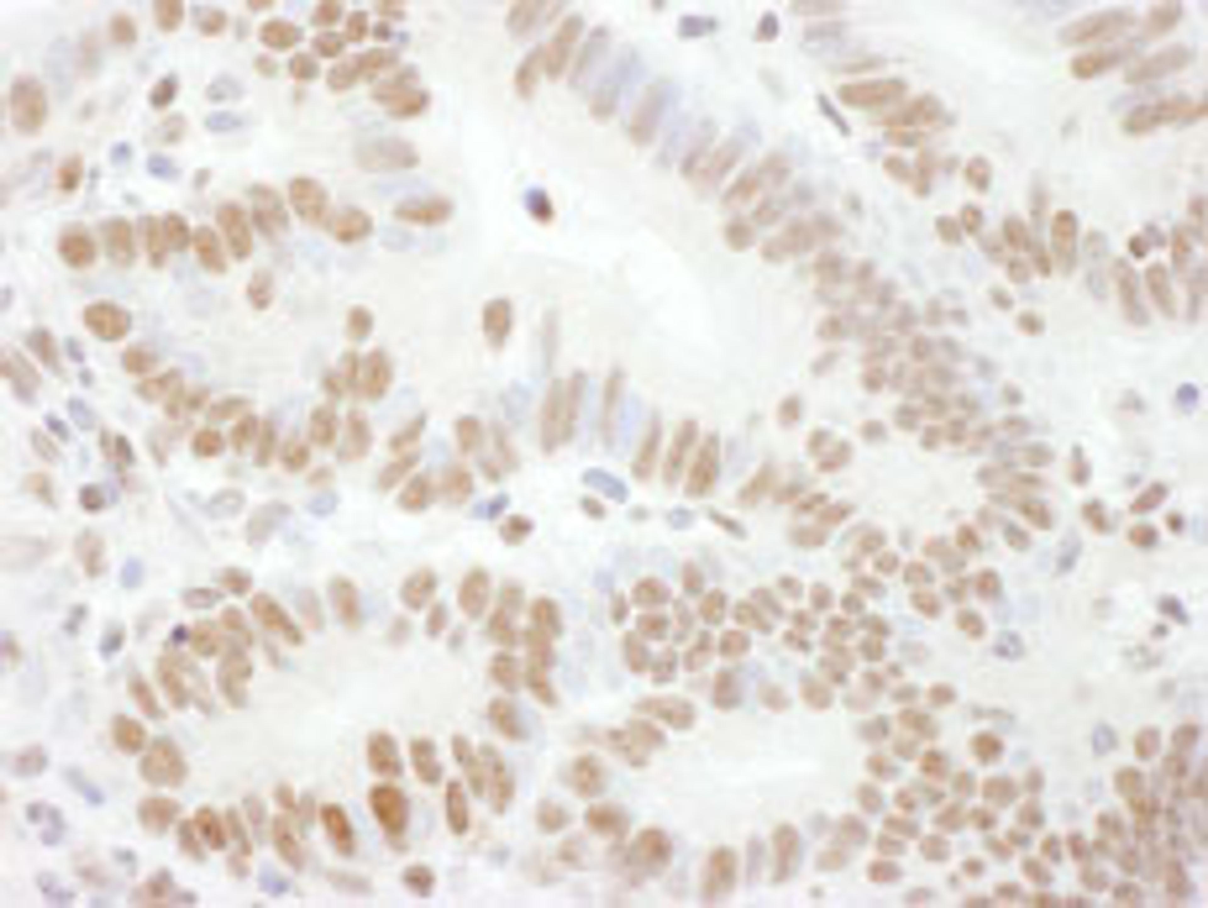 Detection of human Phospho Rad17 (S645) by immunohistochemistry.