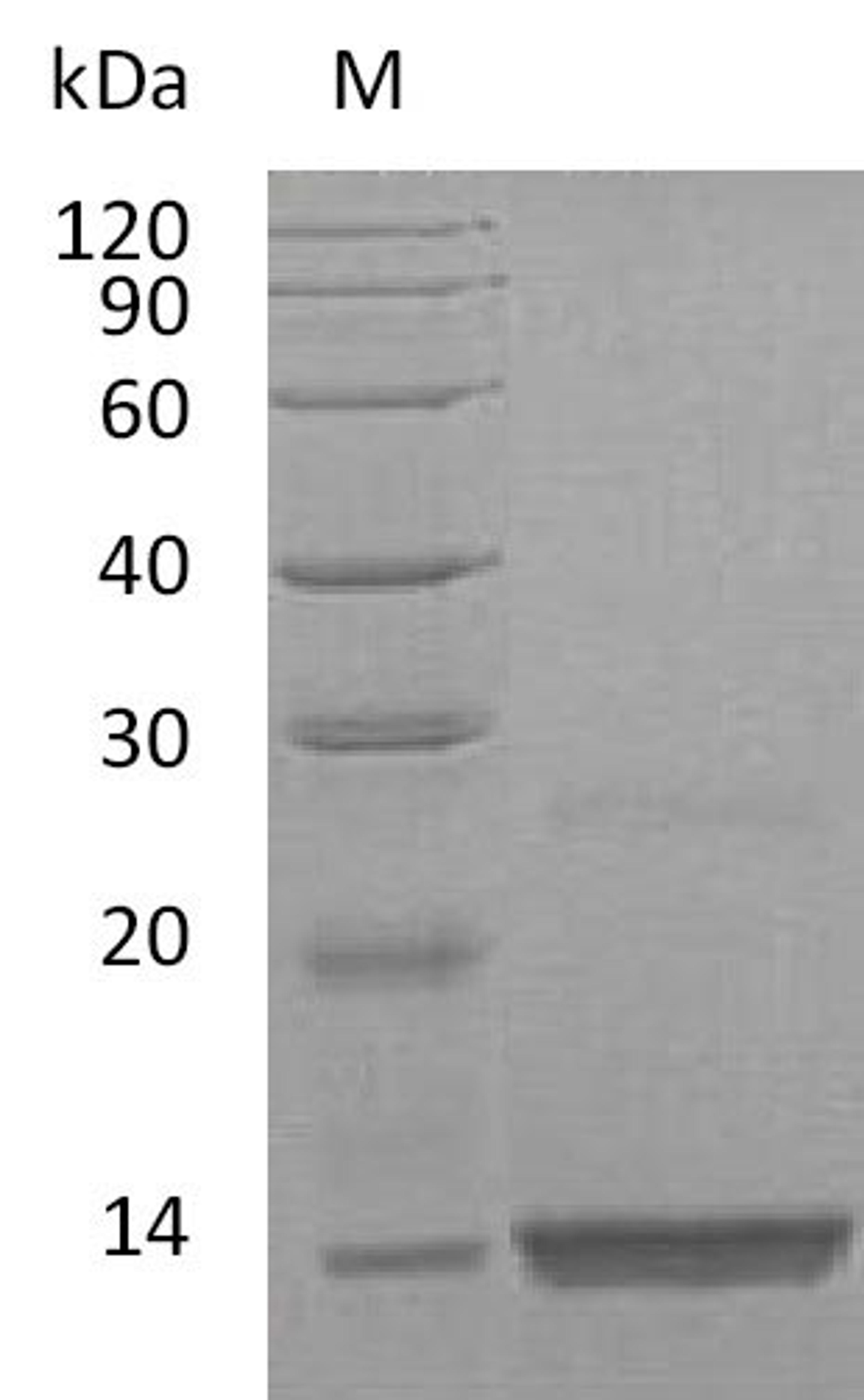 (Tris-Glycine gel) Discontinuous SDS-PAGE (reduced) with 5% enrichment gel and 15% separation gel.