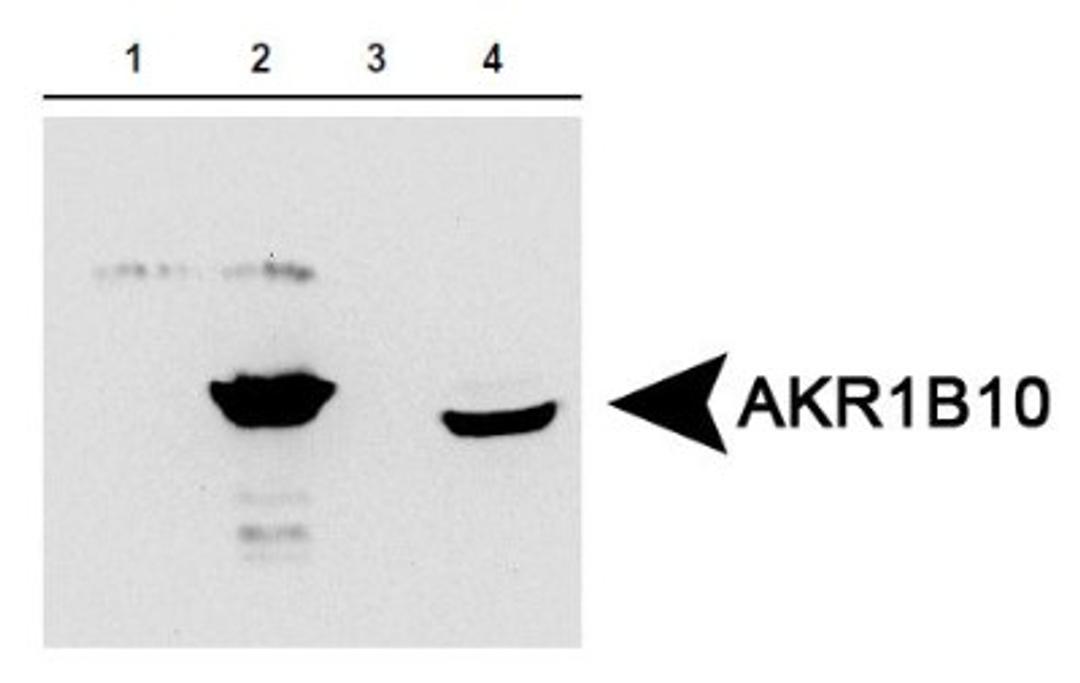 Western Blot: AKR1B10 Antibody [NBP1-44998] - AKR1B10 expression in 1) aldose reductase (AR) protein, 2) AKR1B10 protein, 3) 293T cells expressing AR and 4) HCT-8 cells expressing AKR1B10. Image courtesy of the laboratory of Dr. Deliang Cao at Southern Illinois University School of Medicine.