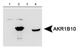 Western Blot: AKR1B10 Antibody [NBP1-44998] - AKR1B10 expression in 1) aldose reductase (AR) protein, 2) AKR1B10 protein, 3) 293T cells expressing AR and 4) HCT-8 cells expressing AKR1B10. Image courtesy of the laboratory of Dr. Deliang Cao at Southern Illinois University School of Medicine.