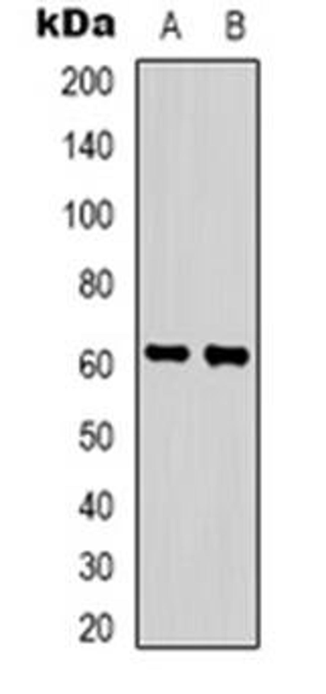 Western blot analysis of ZNF397 expression in HepG2 (Lane 1), Hela (Lane 2) whole cell lysates using ZNF397 antibody