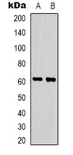 Western blot analysis of ZNF397 expression in HepG2 (Lane 1), Hela (Lane 2) whole cell lysates using ZNF397 antibody