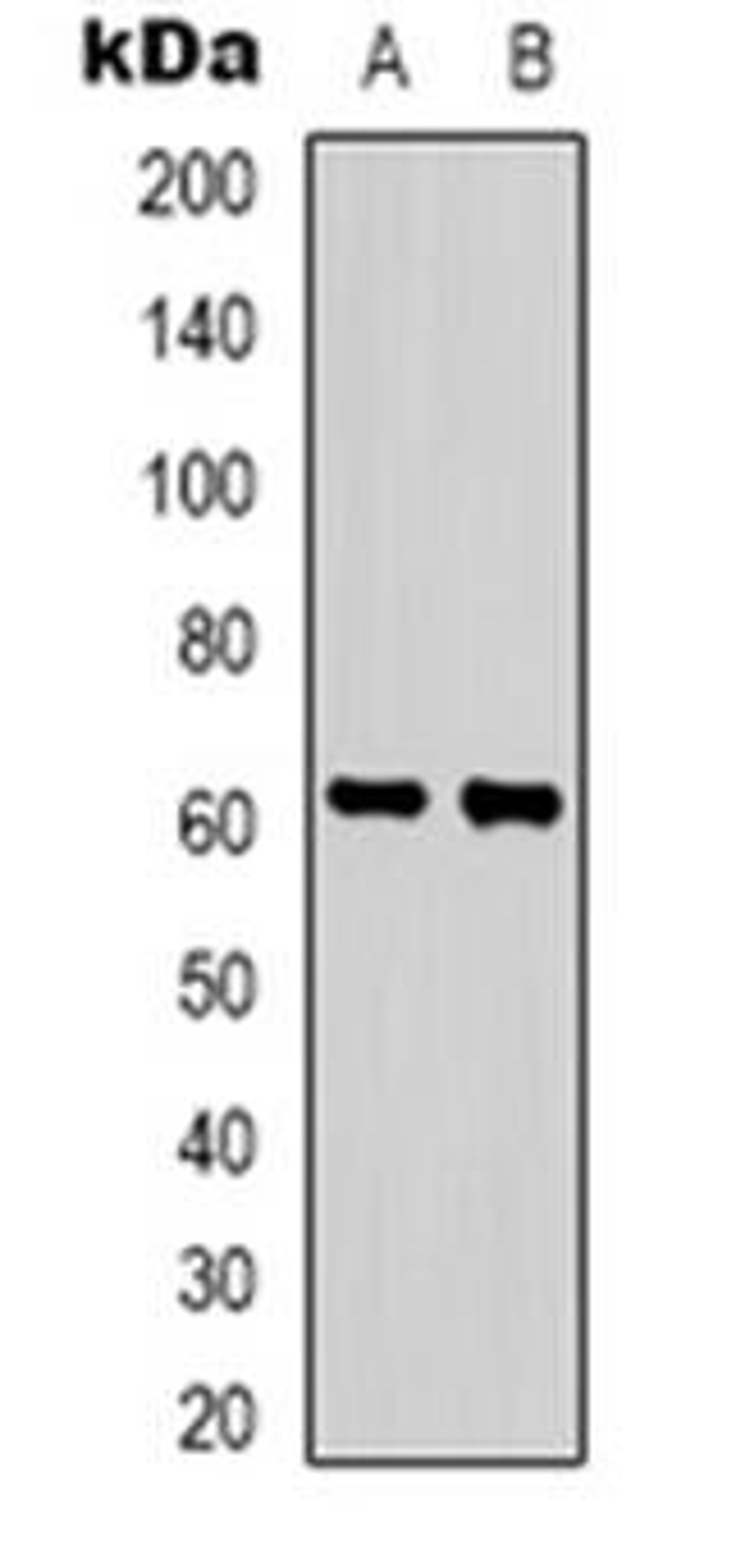 Western blot analysis of ZNF397 expression in HepG2 (Lane 1), Hela (Lane 2) whole cell lysates using ZNF397 antibody