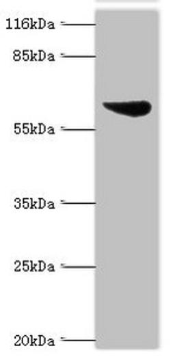 Western blot. All lanes: Set1/Ash2 histone methyltransferase complex subunit ASH2 antibody at 2ug/ml + K562 whole cell lysate. Secondary. Goat polyclonal to rabbit IgG at 1/10000 dilution. Predicted band size: 69, 57, 61 kDa. Observed band size: 69 kDa. 