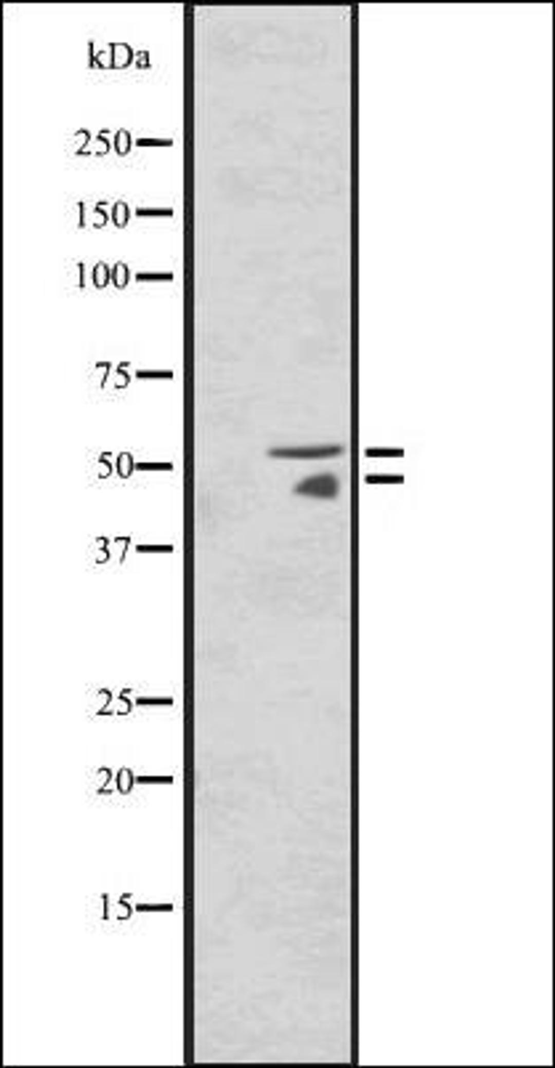 Western blot analysis of HepG2 cell lysate using HNF4A/G antibody