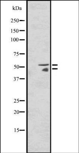 Western blot analysis of HepG2 cell lysate using HNF4A/G antibody