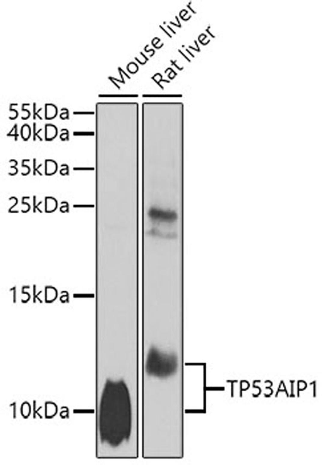 Western blot - TP53AIP1 antibody (A7224)