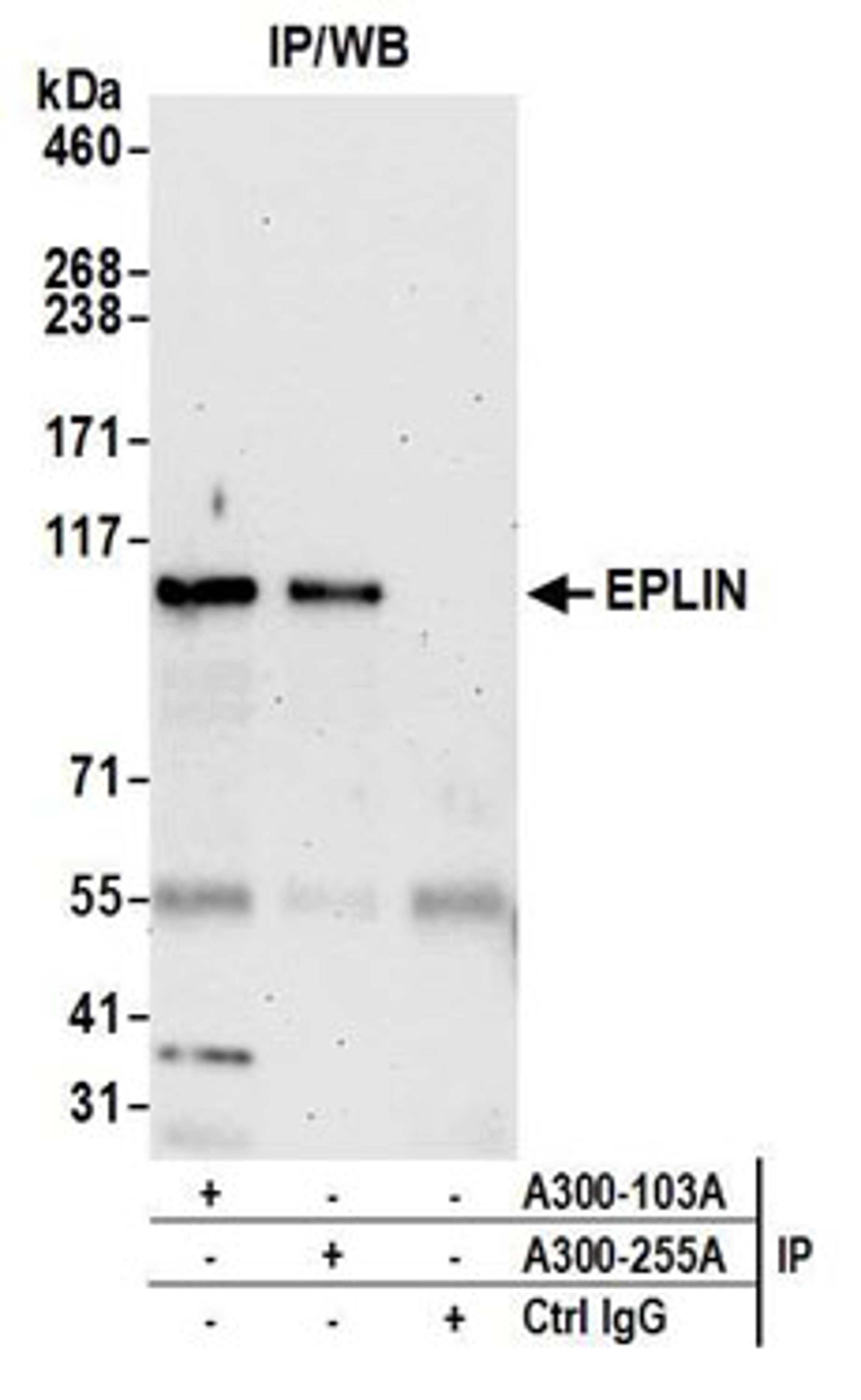 Detection of human EPLIN by western blot of immunoprecipitates.