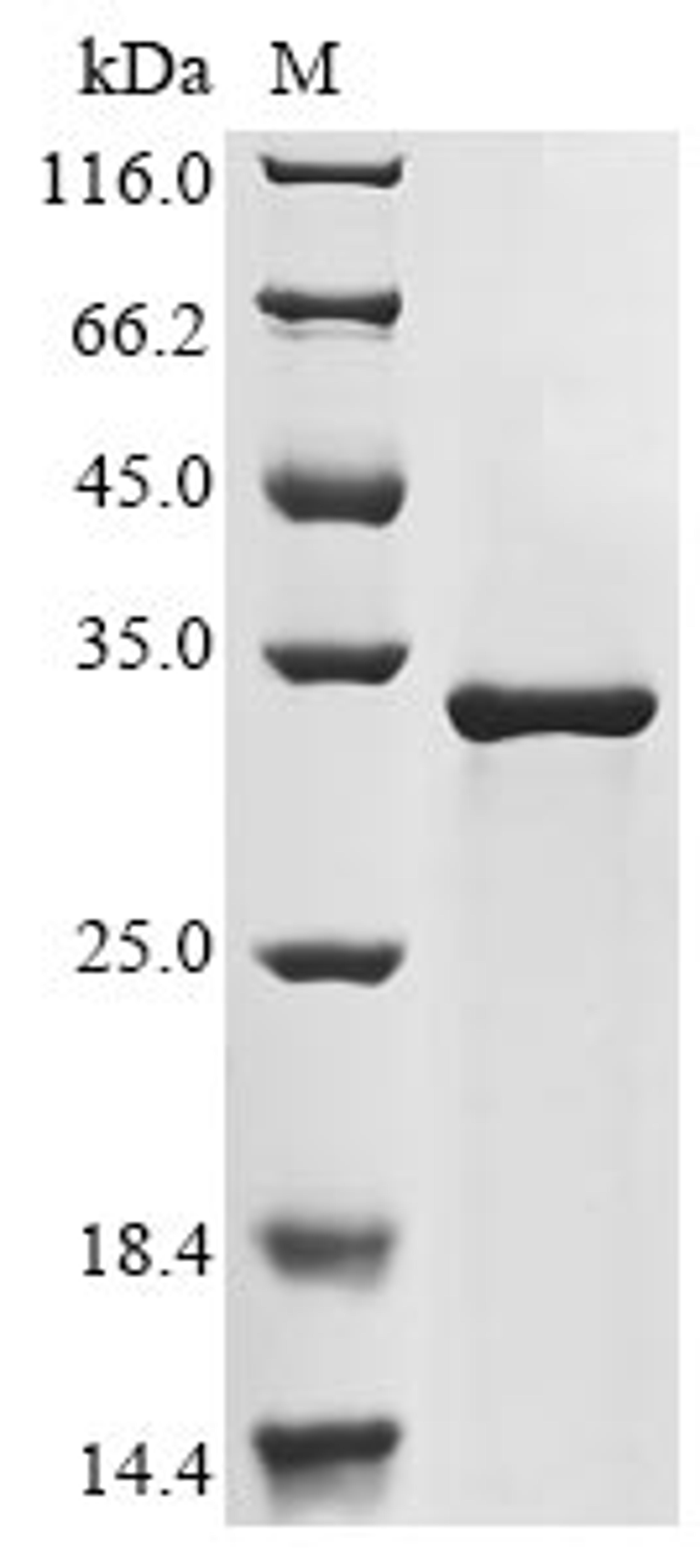 (Tris-Glycine gel) Discontinuous SDS-PAGE (reduced) with 5% enrichment gel and 15% separation gel.