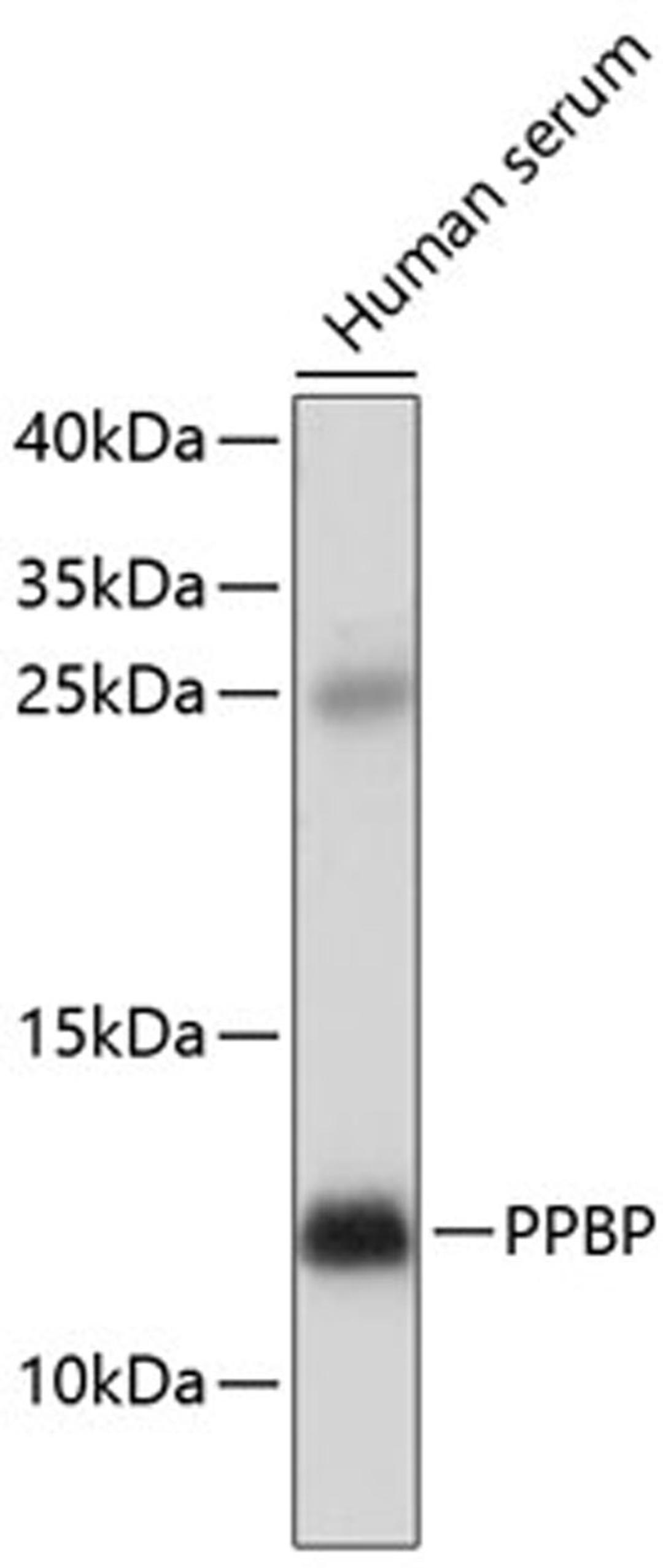 Western blot - PPBP antibody (A1925)