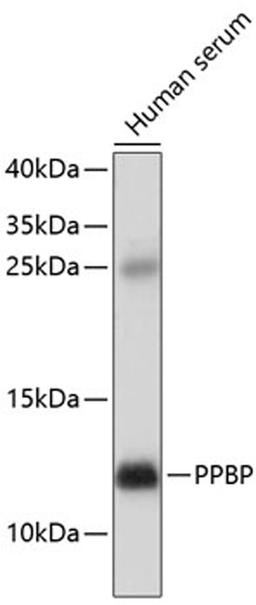 Western blot - PPBP antibody (A1925)