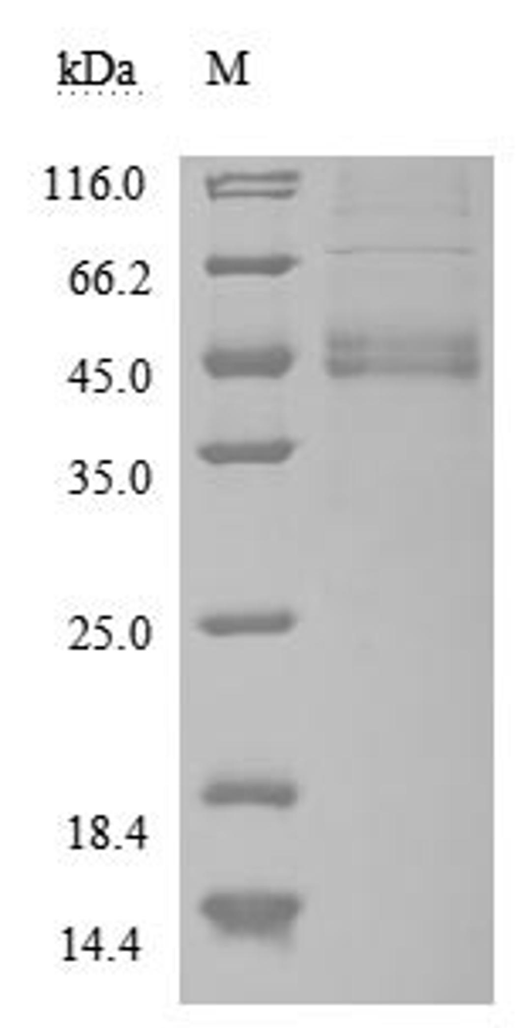 (Tris-Glycine gel) Discontinuous SDS-PAGE (reduced) with 5% enrichment gel and 15% separation gel.