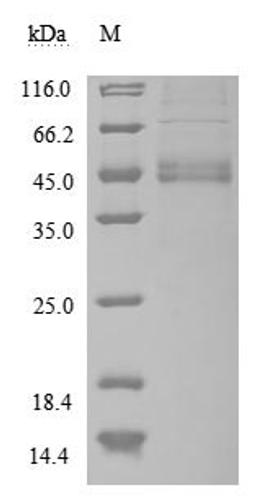 (Tris-Glycine gel) Discontinuous SDS-PAGE (reduced) with 5% enrichment gel and 15% separation gel.