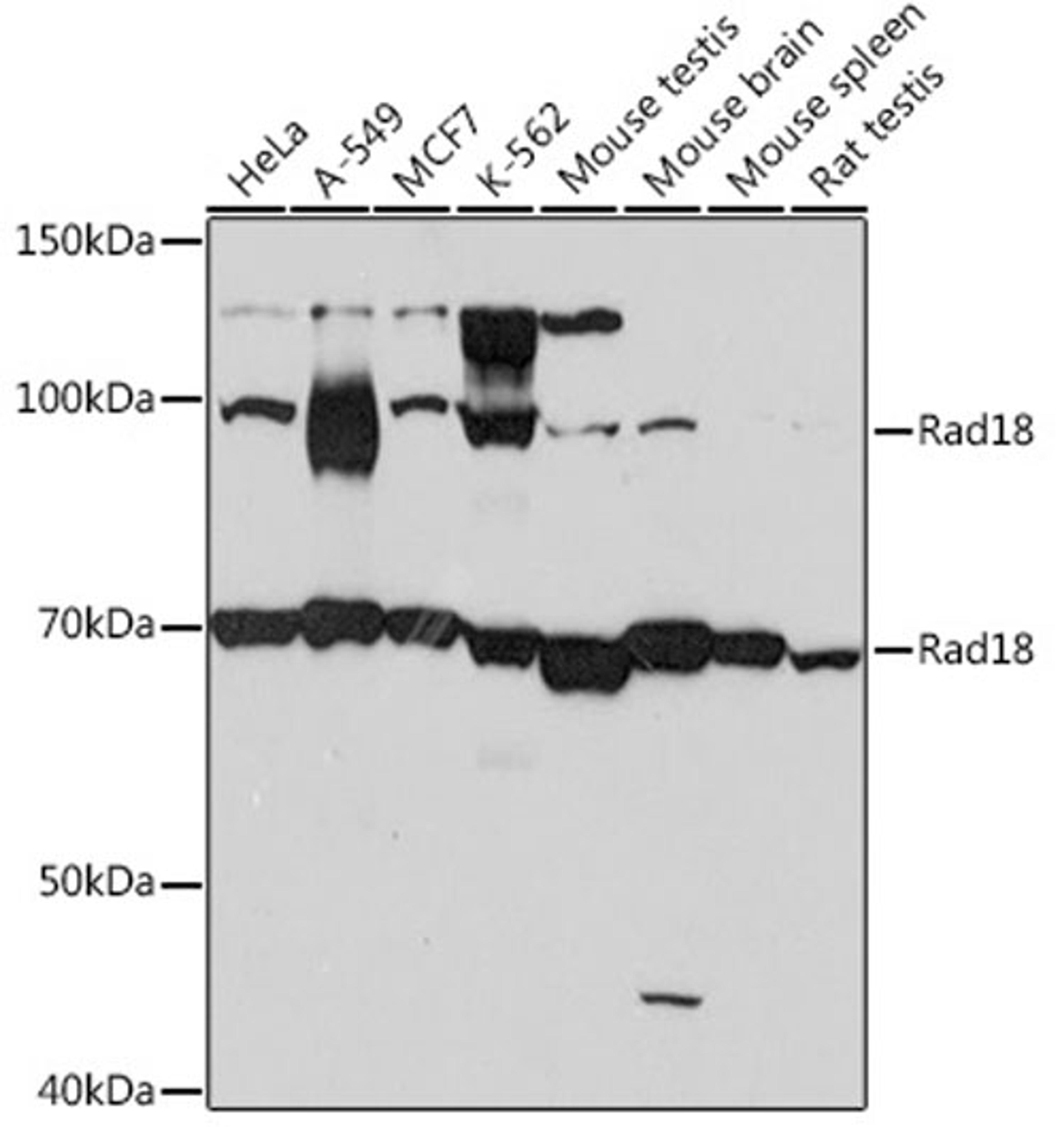 Western blot - Rad18 Rabbit mAb (A4339)