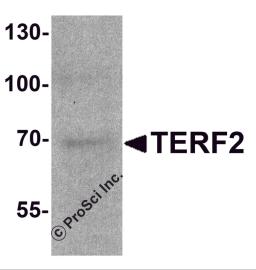 Western blot analysis of TERF2 in 293 cell lysate with TERF2 antibody at 1 &#956;g/ml.