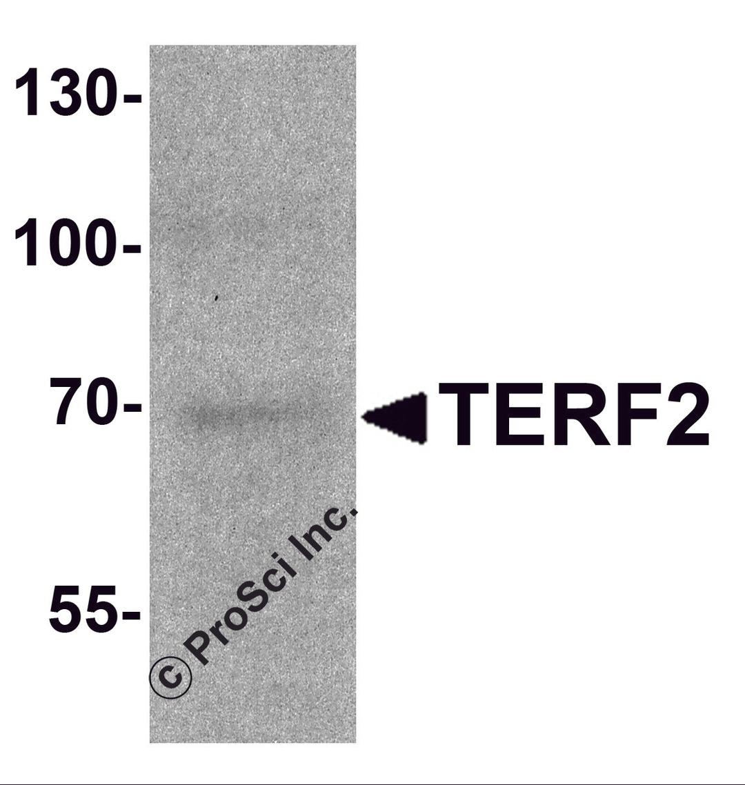 Western blot analysis of TERF2 in 293 cell lysate with TERF2 antibody at 1 μg/ml.