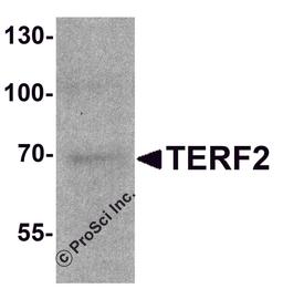 Western blot analysis of TERF2 in 293 cell lysate with TERF2 antibody at 1 μg/ml.