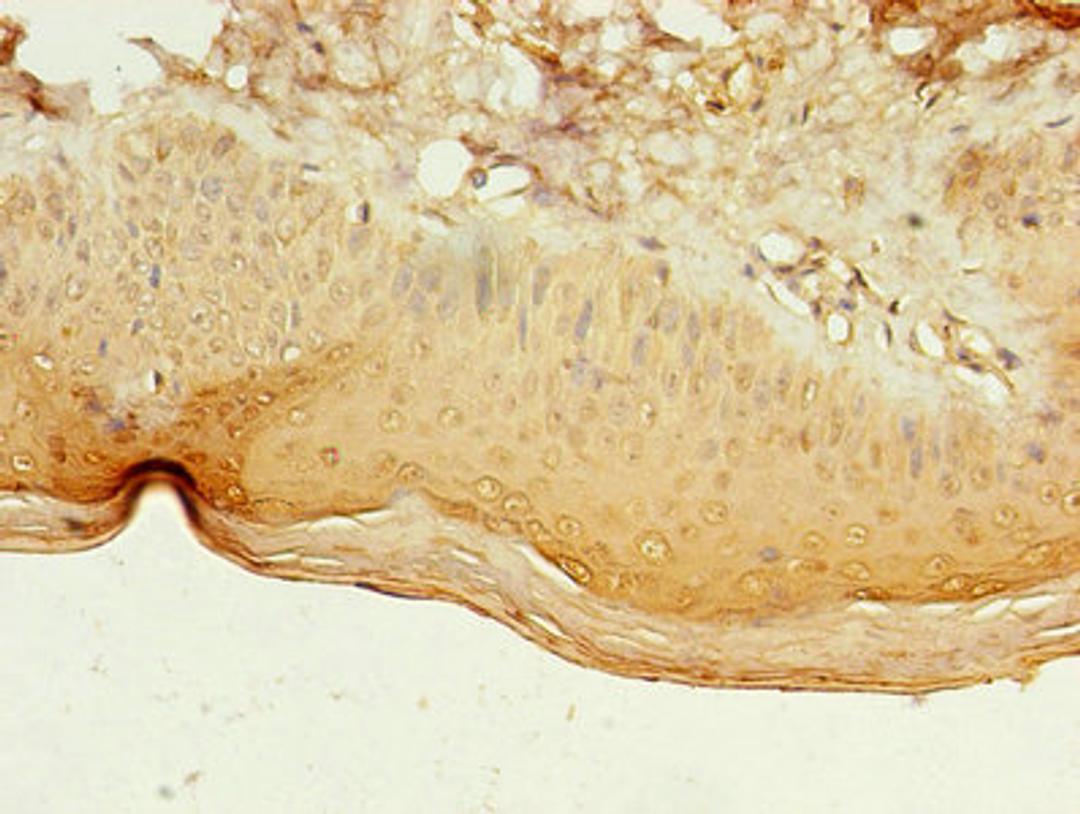 Immunohistochemistry of paraffin-embedded human skin tissue using CSB-PA012936LA01HU at dilution of 1:100